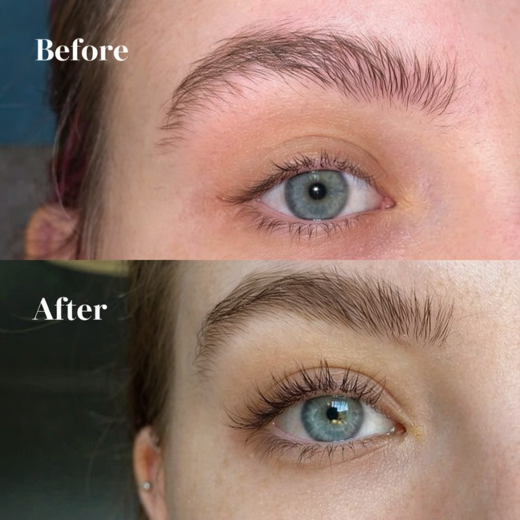 Natural Eyelash Growth Serum – Longer, Denser Lashes